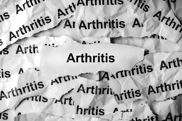 istock Strips of newspapers with the words Arthritis printed on them. 1368603061