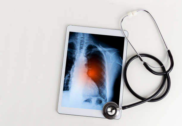 tavoletta digitale con immagine a raggi x - human lung asthmatic x ray human internal organ foto e immagini stock