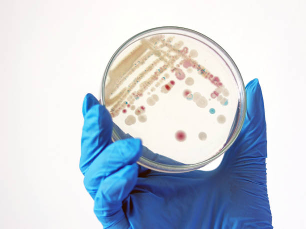 le chercheur tient une boîte de petri de vibrio vulnificus dans chromagar et tcbs, une bactérie estuarienne présente dans l’ingestion de la bactérie dans les mollusques filtreurs, tels que les huîtres. - petri dish medical research bacterium contagion photos et images de collection