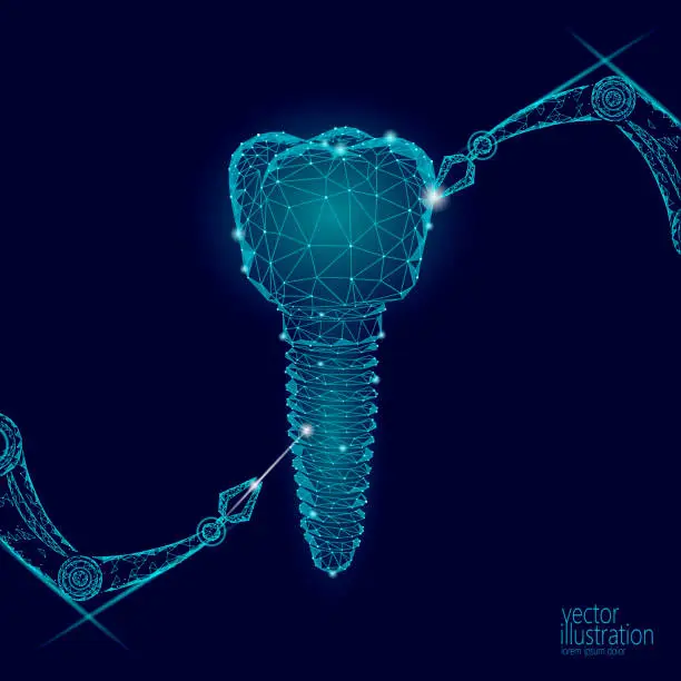 Vector illustration of 3d tooth innovation robot arm polygonal concept. Stomatology symbol low poly triangle abstract oral dental medical care business. Connected dot particle implant render blue vector illustration