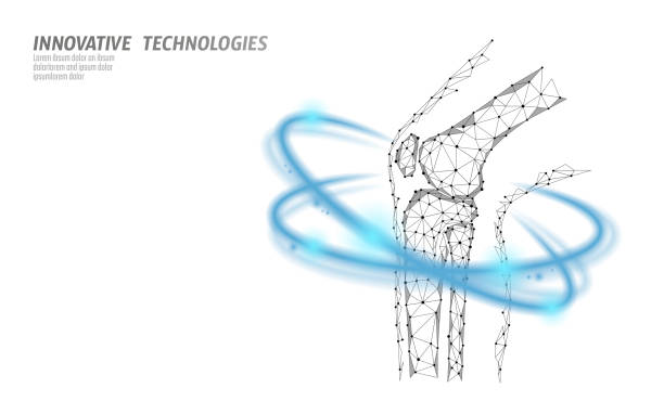 illustrations, cliparts, dessins animés et icônes de modèle 3d conjointe genou humain vector illustration. poly faible conception future technologie cure traitement de la douleur. fond bleu et rouge blessure homme corps jambe médecine modèle - human knee pain human spine human joint