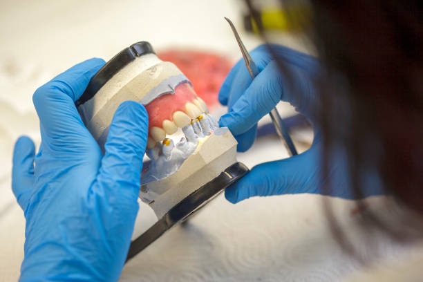 dental técnico trabajando en un modelo de mordaza - technician dentures prosthetic equipment workshop fotografías e imágenes de stock