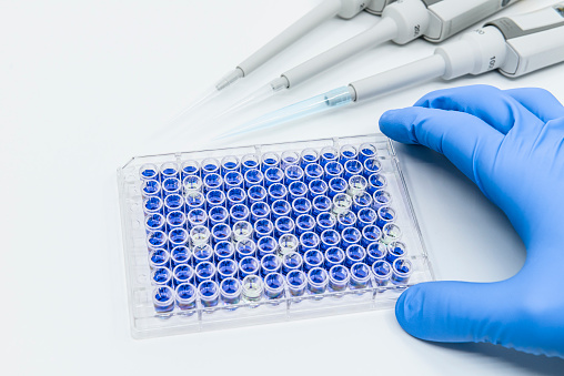 Scientist is holding 96 well micro plate  for ELISA immunoassay with pipettes