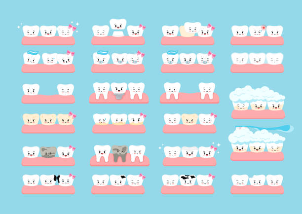 Cute teeth braces, implant, crooked and with tartar veneer in gum isolated. Cute teeth braces, implant, crooked and with tartar veneer in gum isolated. Oral health and dental surgery prosthetics treatment concept with kids kawaii funny teeth. Flat cartoon vector illustration. cute cartoon dental implants stock illustrations