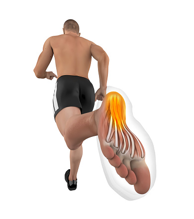 3D illustration of a man running. Angle emphasizing the rear foot injury. Isolated on white background. Great to be used for works of health and lifestyle.