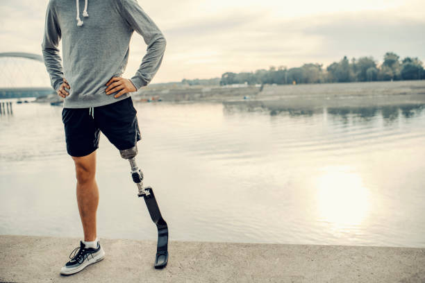 A fit sportsman with prosthetic leg standing at the quay with hands on hips. Proud handicapped man. stock photo