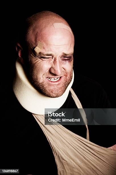 Heridas Hombre Foto de stock y más banco de imágenes de Adulto - Adulto, Adulto de mediana edad, Brazo fracturado