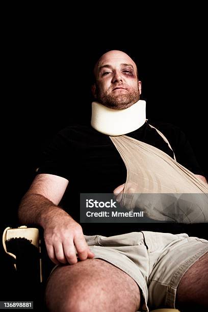 Heridas Hombre Foto de stock y más banco de imágenes de Brazo fracturado - Brazo fracturado, Hombres, Adulto