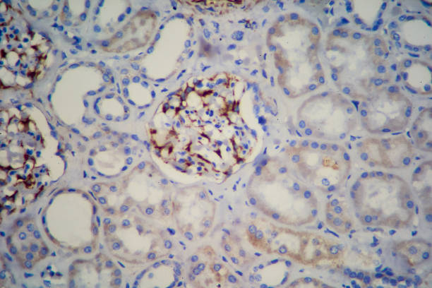 istock Immunohistochemistry Endothelial cells and glomerulus, kidney sample. 1369004015