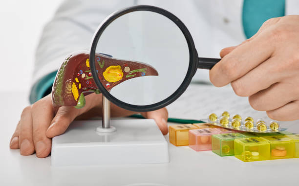 Human liver disease, diagnosis and liver treatment. Doctor showing liver anatomical model for treatment hepatitis, cirrhosis and cancer stock photo