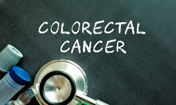 colorectal cancer word, medical term word with medical concepts in blackboard and medical equipment stock photo