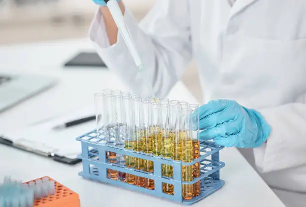 Photo of Closeup shot of an unrecognisable scientist working with samples in a lab