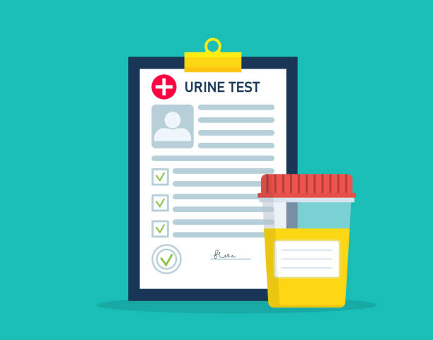 ilustrações de stock, clip art, desenhos animados e ícones de urine test in jar with form of analysis result. sample of urine test for laboratory. specimen of pee in container for examination. urinalysis for exam of ph, diabetes, disease. vector - doping