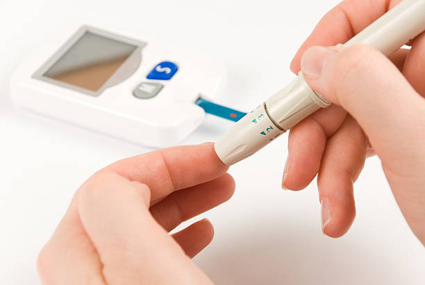 혈당 테스트 - diabetes high up blood sugar test glucose 뉴스 사진 이미지