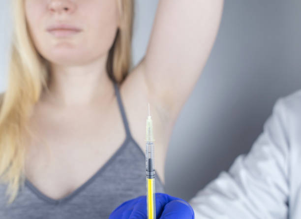 istock Armpit injection botulinum toxin. Cream marking for injection sites. Pain relief before the procedure. Local anesthesia. Anhidrosis therapy. Decreased sweating. Eliminates unpleasant underarm odor. 1369520363