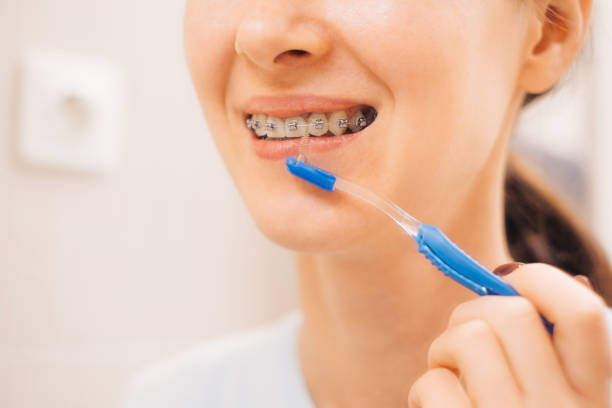 istock Young woman brushing her teeth with braces. 1369553811