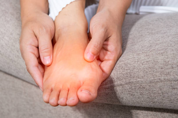 close-up of a woman massage painful toes at home. bare foot of woman with painful red bunion (hallux valgus) and injury foot, problems from wearing high heel. medical foot problem. - plattfot bildbanksfoton och bilder