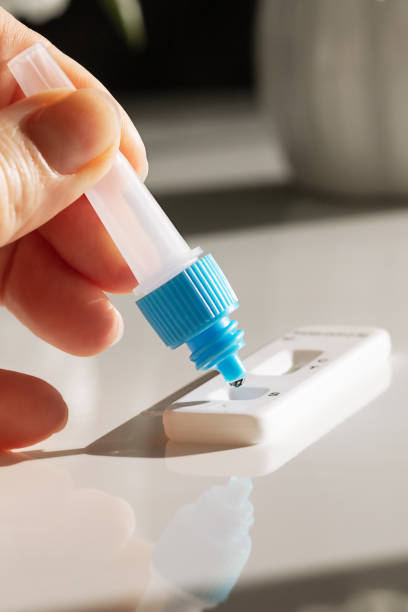istock conducting a covid and disease test with a set and arm on a white background 1369757503
