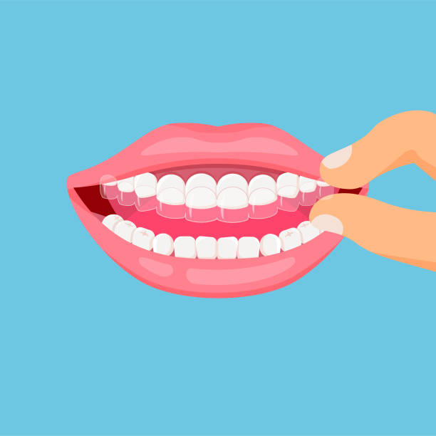 Teeth with transparent braces. Mouth guard. Teeth with transparent braces. Alignment of teeth by aligners. Orthodontic dentistry concept. Dental care. Vector illustration isolated on blue background. orthodontist stock illustrations