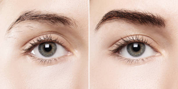 istock Comparison of female brow after eyebrow shape correction 1370102523