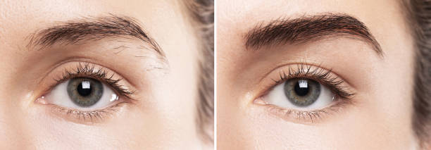 istock Comparison of female brow after eyebrow shape correction 1370102602