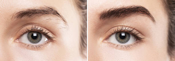 Comparison of female brow after eyebrow shape correction Comparison of female brow after eyebrow shape correction  or permanent makeup permanent makeup before and after stock pictures, royalty-free photos & images