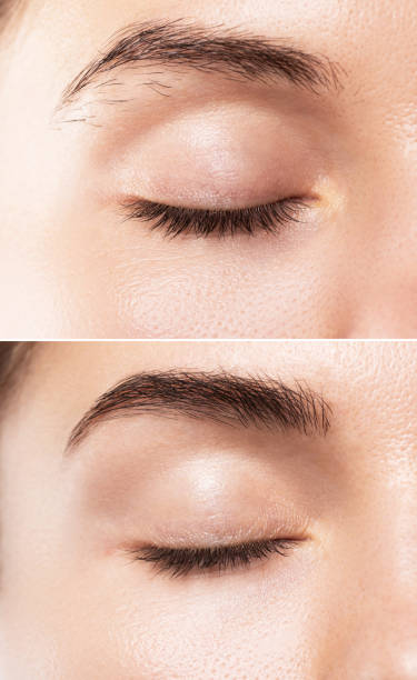 Comparison of female brow after eyebrow shape correction Comparison of female brow after eyebrow shape correction  or permanent makeup permanent makeup before and after stock pictures, royalty-free photos & images