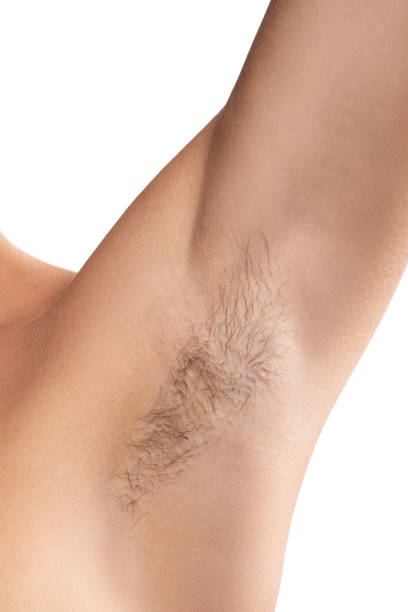 istock Closeup of hairy female armpit 1370102908