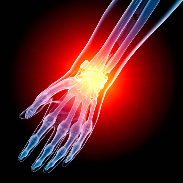 dolore radiografia del polso - human bone forensic science medical scan morphology foto e immagini stock