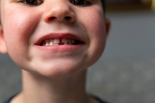 giovane ragazzo che mostra il suo dente recentemente caduto alla telecamera. - child human teeth brushing teeth dental hygiene foto e immagini stock