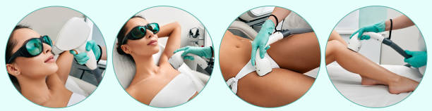 Medical laser hair removal, body epilation procedure. Laser hair removal technology, say goodbye to hair on legs, armpits, bikini and lips area Medical laser hair removal, body epilation procedure. Laser hair removal technology, say goodbye to hair on legs, armpits, bikini and lips area hair removal stock pictures, royalty-free photos & images