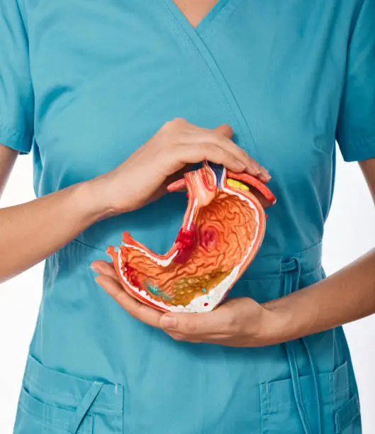 Photo of Diagnosis and treatment of stomach disease. Doctor holding anatomical model of stomach with pathologies. Stomach health concept