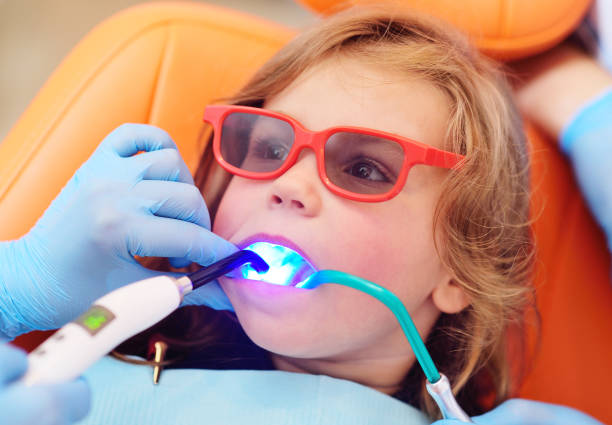 pediatric dentist seals the teeth of a little girl in a pediatric dental clinic. A doctor using dental ultraviolet curing light to polymerize a seal a pediatric dentist seals the teeth of a little girl in a pediatric dental clinic. A doctor using dental ultraviolet curing light to polymerize a seal dental light stock pictures, royalty-free photos & images