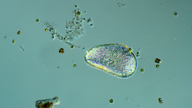 Microorganisms under the microscope
