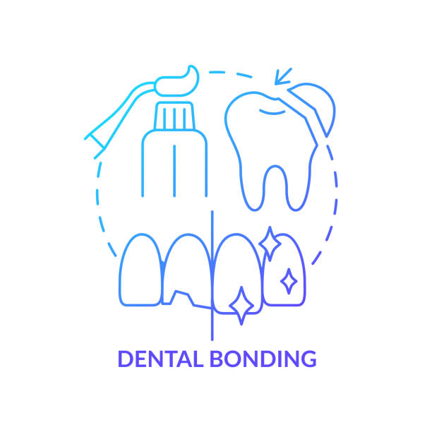 Dental bonding blue gradient concept icon Dental bonding blue gradient concept icon. Cosmetic enhancement type abstract idea thin line illustration. Cracked and broken teeth recovery. Isolated outline drawing. Myriad Pro-Bold font used teeth bonding stock illustrations
