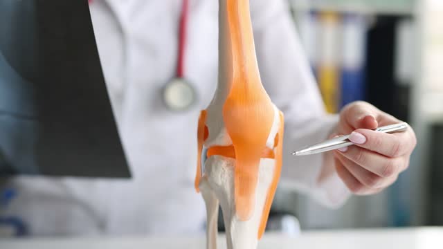 730 Knee Osteoarthritis Stock Videos and Royalty-Free Footage - iStock |  Stage of knee osteoarthritis