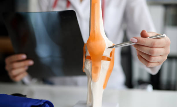 Doctor with xray in his hands showing structure of knee joint on artificial model closeup stock photo