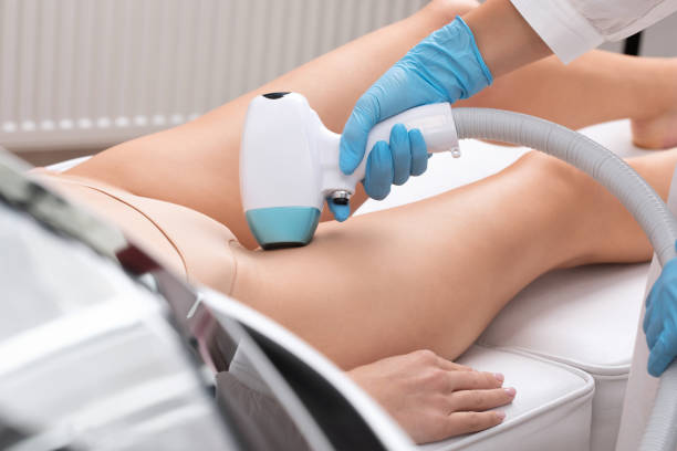 Elos epilation hair removal procedure on a woman procedimiento de depilación elos en el cuerpo de una mujer