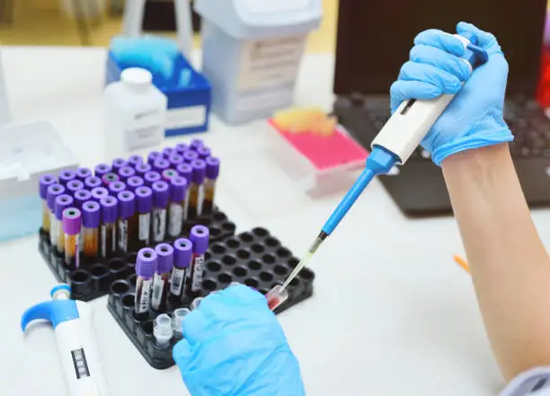 Photo of scientist in a medical laboratory with a dispenser in his hands is doing an analysis