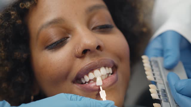 Close up of dentist and assistant choosing color of veneers for african female patient