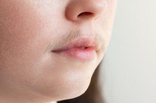 A close-up of caucasian woman's face with a mustache over her upper lip. The concept of hair removal and depilation.