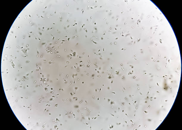 Sperm or semen analysis showing normal count with morphology. stock photo