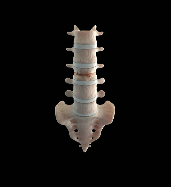 frattura da compressione lombare - thoracic vertebrae lumbar vertebra cervical vertebrae sacrum foto e immagini stock