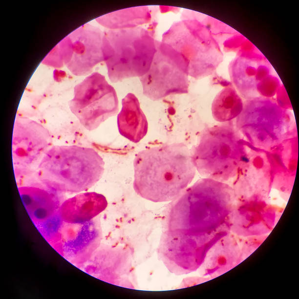 istock Bacteria cell Gram neagative bacilli with capsule.Sample sputum in Gram stain method. 1370827667