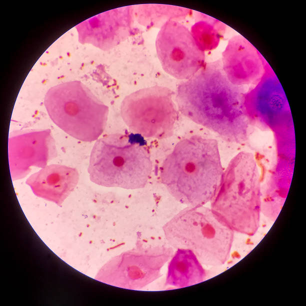 istock Bacteria cell Gram neagative bacilli with capsule.Sample sputum in Gram stain method. 1370827673