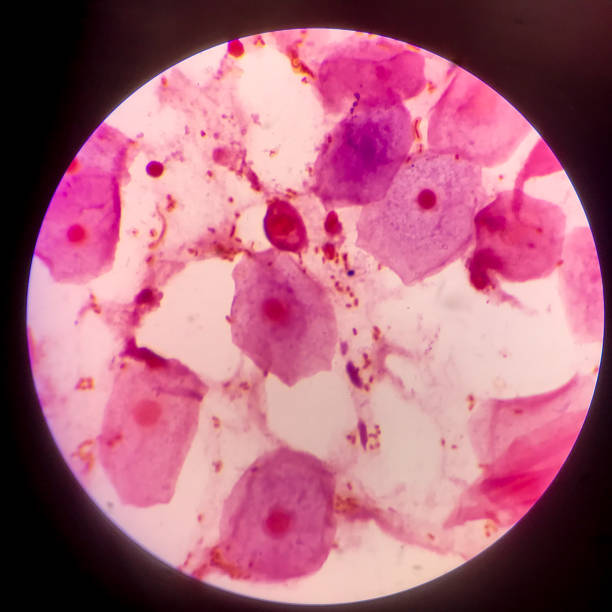 istock Bacteria cell Gram neagative bacilli with capsule.Sample sputum in Gram stain method. 1370827674