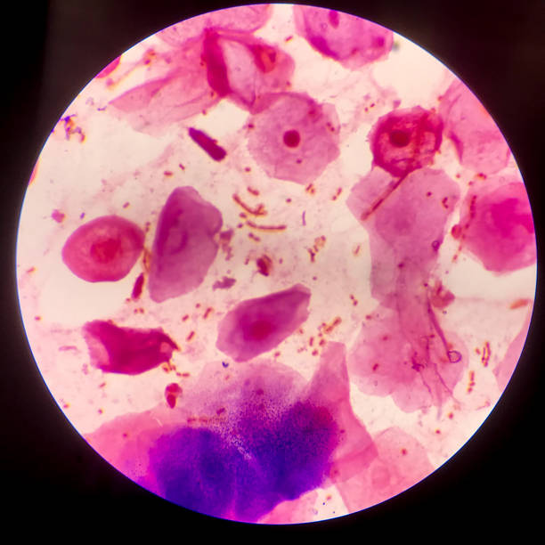 istock Bacteria cell Gram neagative bacilli with capsule.Sample sputum in Gram stain method. 1370827678