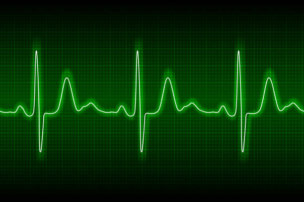 istock Neon heart beat ecg or ekg seamless line on green background 1370984126