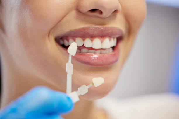 aufnahme einer unkenntlichen frau mit gekappten zähnen beim zahnarzt - peopleimages stock-fotos und bilder