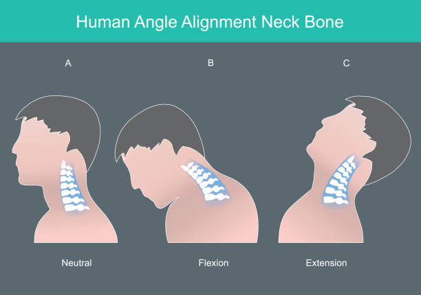 stockillustraties, clipart, cartoons en iconen met human angle alignment neck bone. human neck bone in correct angles. illustration infographic."n - menselijke nek